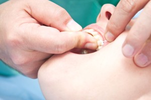 specialist Cosmetic Dentist in Chappaqua NY