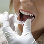 Dental Implants Gaithersburg 
