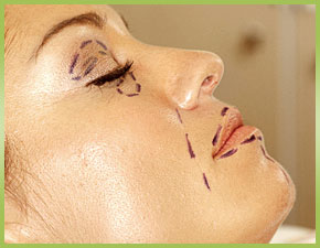 Improve the Beauty and Function of Your Face With Cosmetic Surgery in Dallas