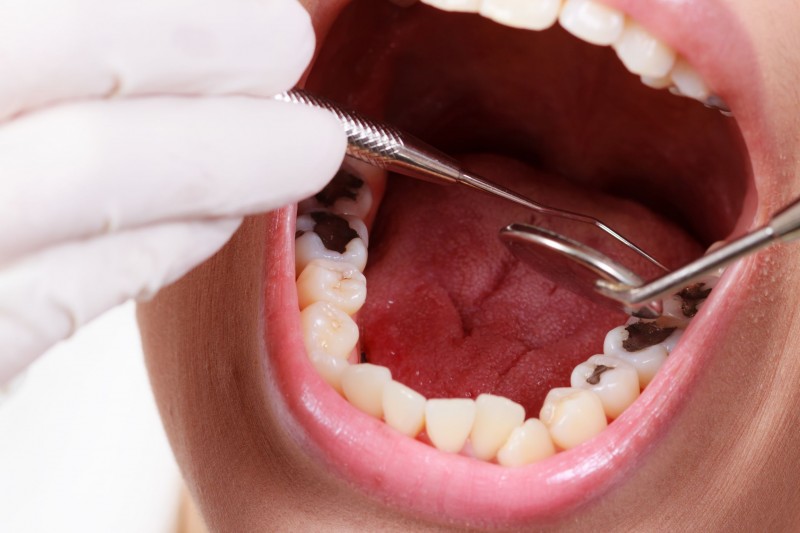 What to Expect from a Dentist in Manassas Park