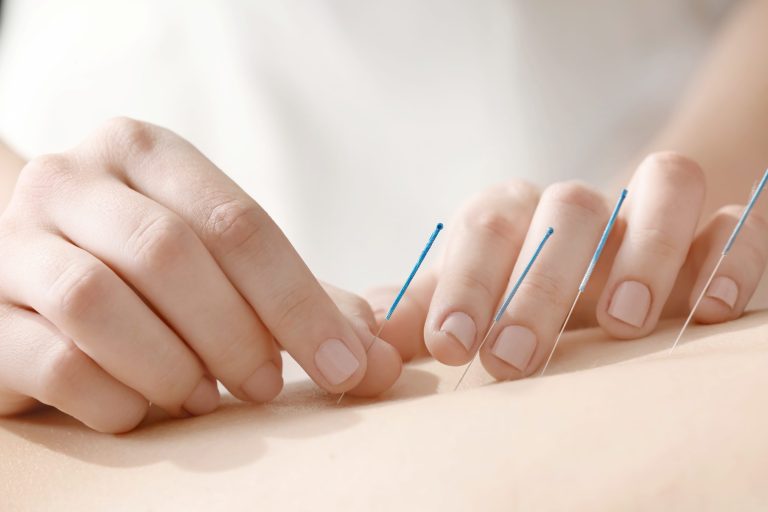 Fertility Acupuncture in Burbank, CA: Harmonizing Mind, Body, and Spirit to Fulfill Parenthood Dreams