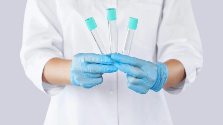Exploring Testosterone Replacement Options in Peachtree City
