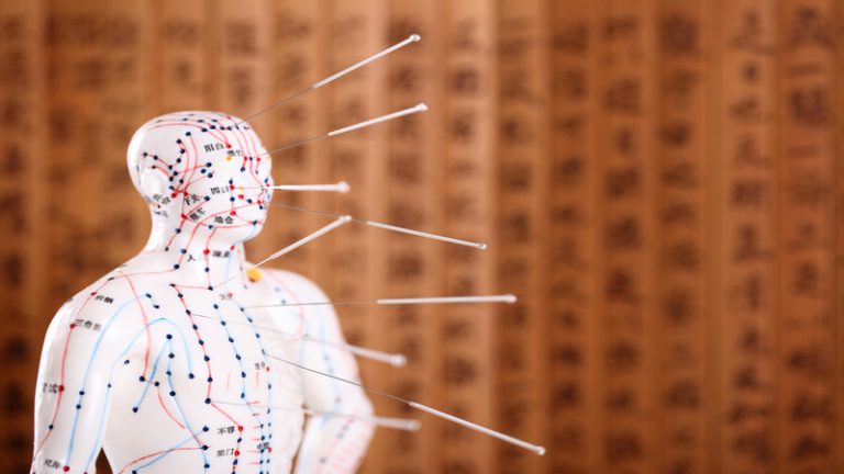 Relax, Heal, and Thrive with Acupuncture Therapy in Costa Mesa, CA