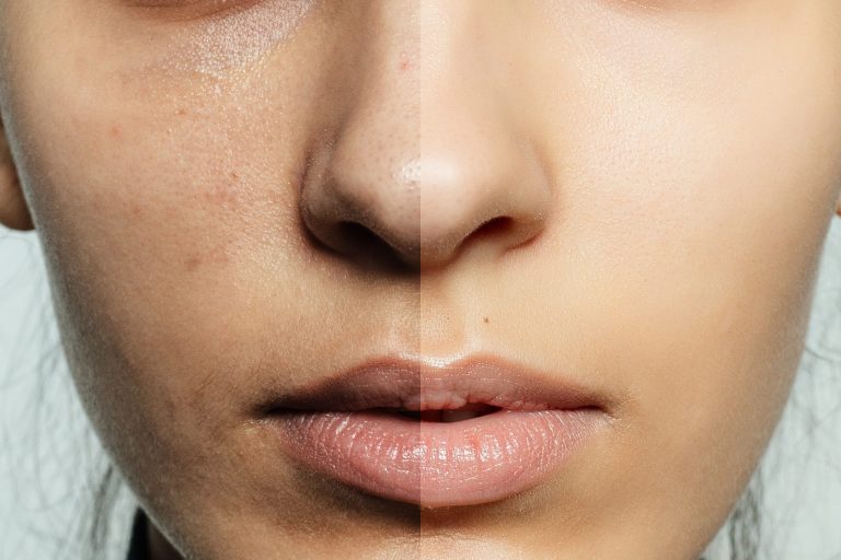 Reveal Your Best Skin Yet: Aging Skin Care in Upper Falls, MD