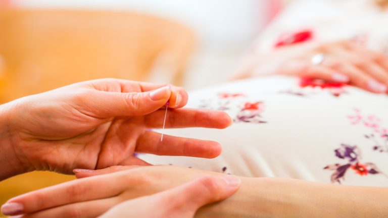 Transform Your Wellbeing With Acupuncture For Anxiety In Newport Beach CA Treatments