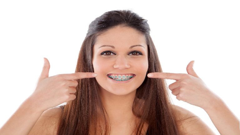 Straighten Your Smile with Invisalign Fort Lauderdale, FL, for a Comfortable Orthodontic Experience