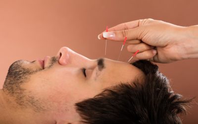 Chronic Pain Relief Is Within Reach With Acupuncture Bellingham WA Solutions