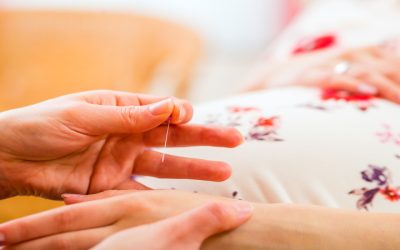 Managing Stress Naturally with Acupuncture For Anxiety, Berkeley, CA Solutions That Work