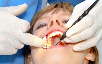 Transform Missing Teeth Solutions With Dental Implants Sunrise, FL Patients Trust