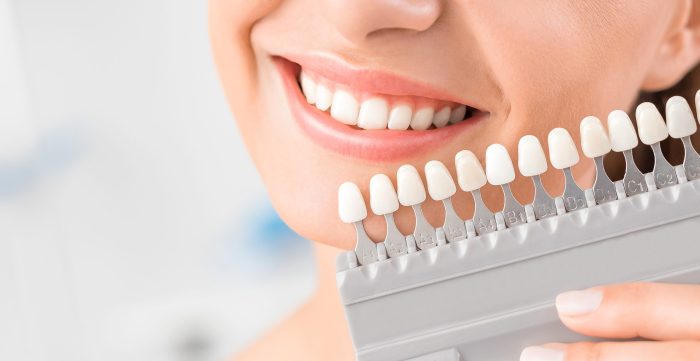 Beautiful smile and white teeth of a young woman.