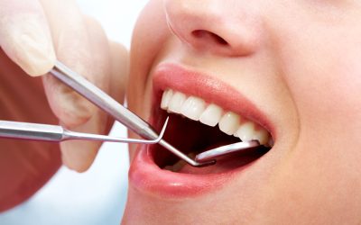 Choosing a Dental Clinic in Janesville, WI, for Affordable Preventive Dental Solutions