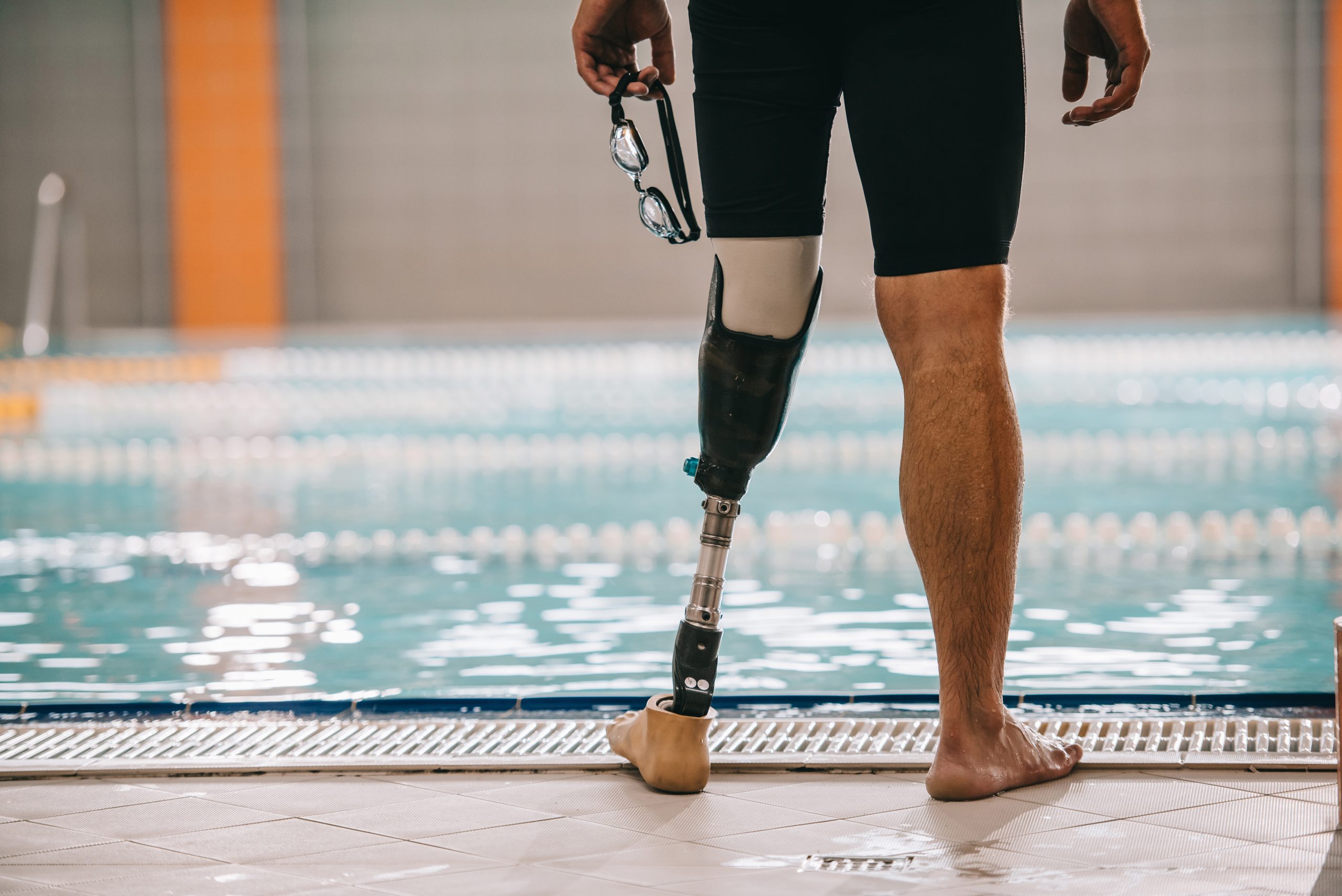 Gain Confidence and Mobility Through Prosthetic Care Services Residents Trust